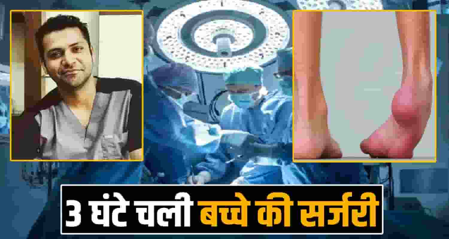 Complex Foot Surgery Doctor Ayush Sharma Tanda Medical College Hospital Kangra