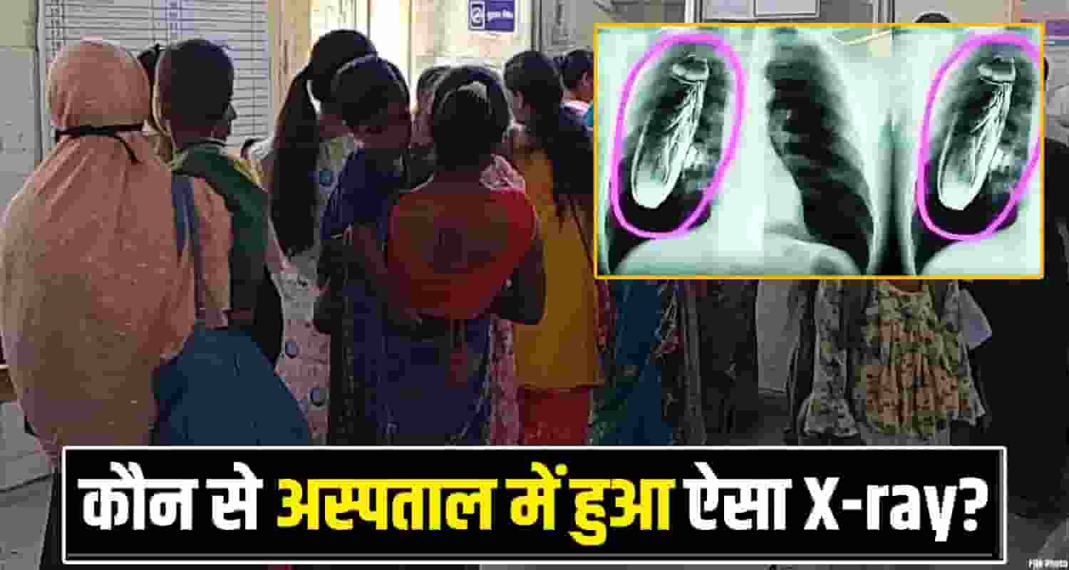 Fake Patient Chest Xray