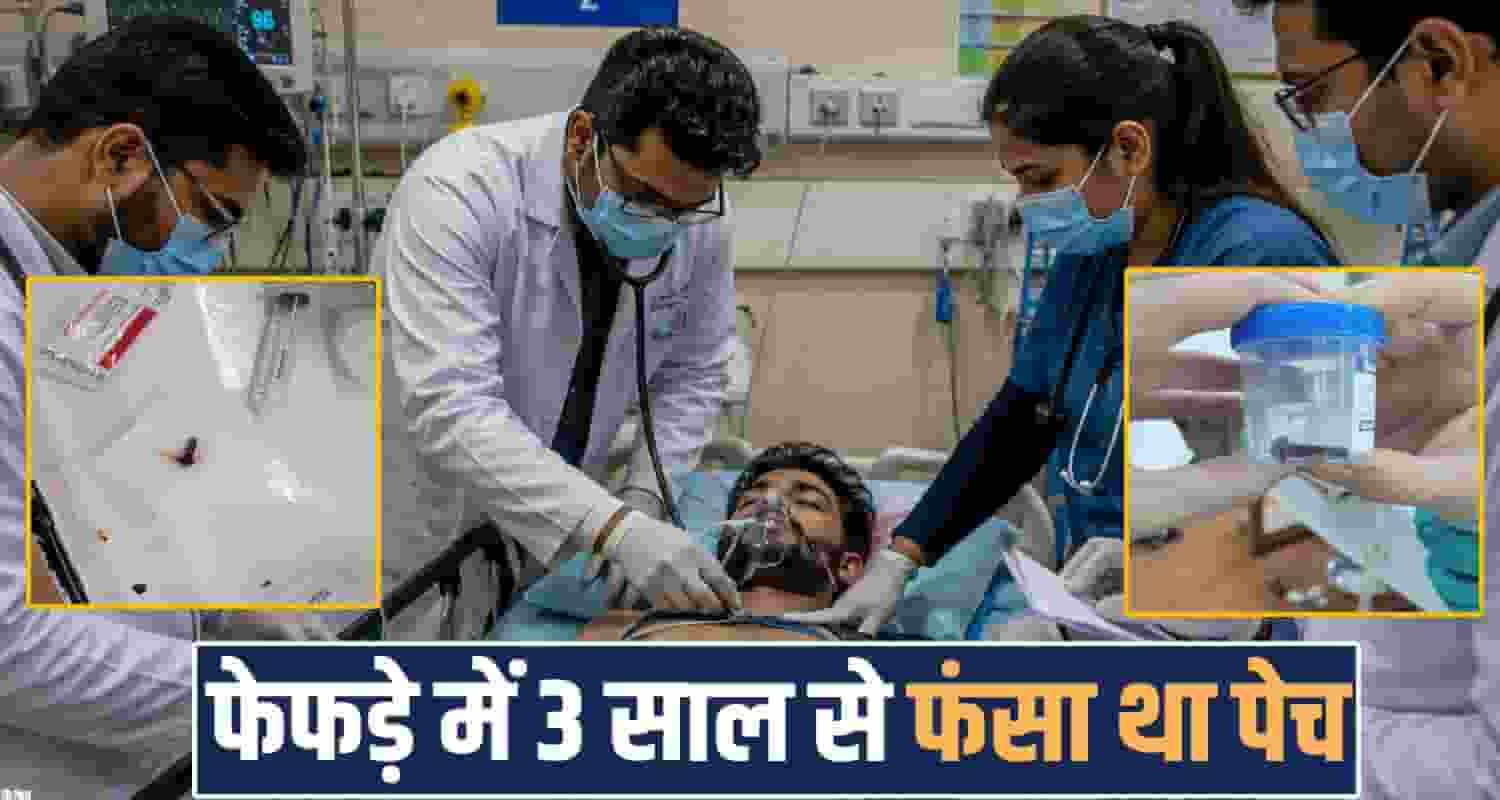 screw young man lung bronchoscopy igmc shimla sirmaur cough boy