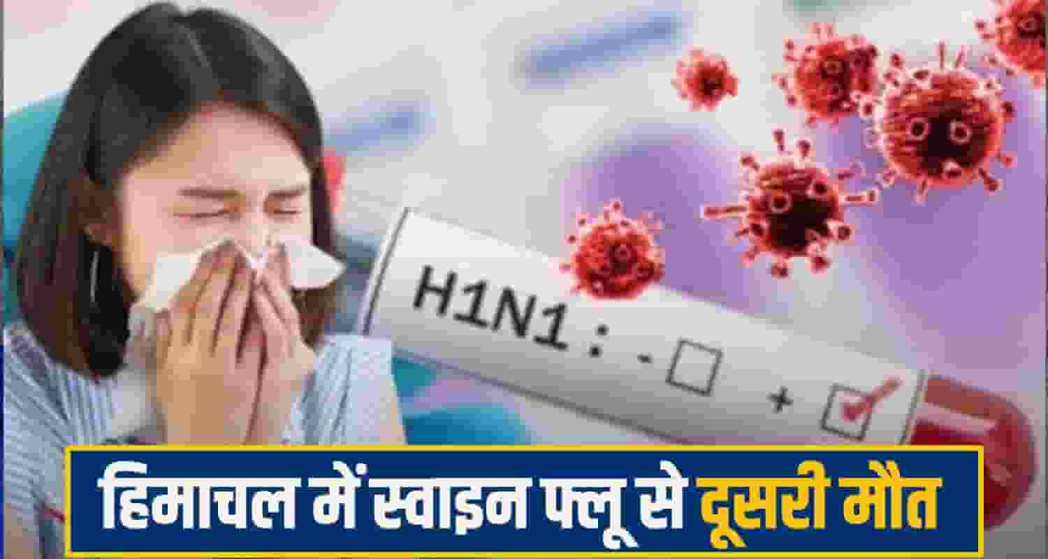 IGMC swine Flu 