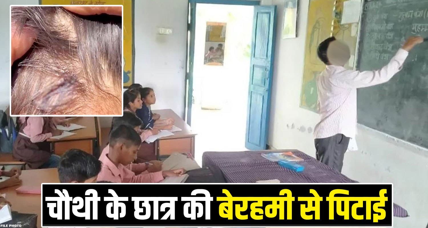 हिमाचल : लोहे के स्केल से टीचर ने छात्र को पी*टा, मां बोली- मेरा इकलौता बेटा, इस पर एक्शन हो Himachal Solan Government School Student Teacher